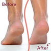 Image of Electric Feet Callus Removal - Dead Skin Removal